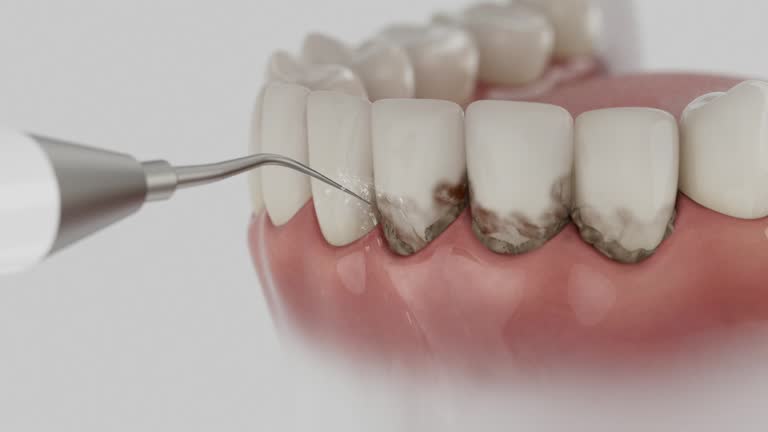 Trusted Dental Implants service in Wickliffe, OH - Dentist Open Now
